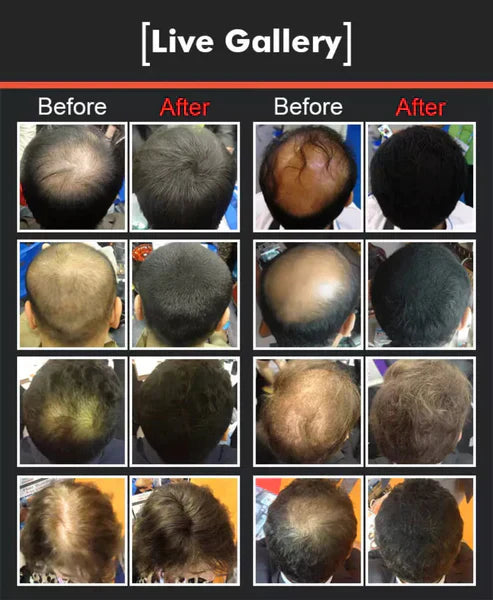 Imported™ Hair Building Fibers – Instant Hair Thickening Solution with Natural Keratin Fibers